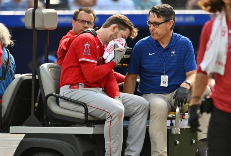 Taylor Ward suffers facial fractures after being hit by 91mph pitch